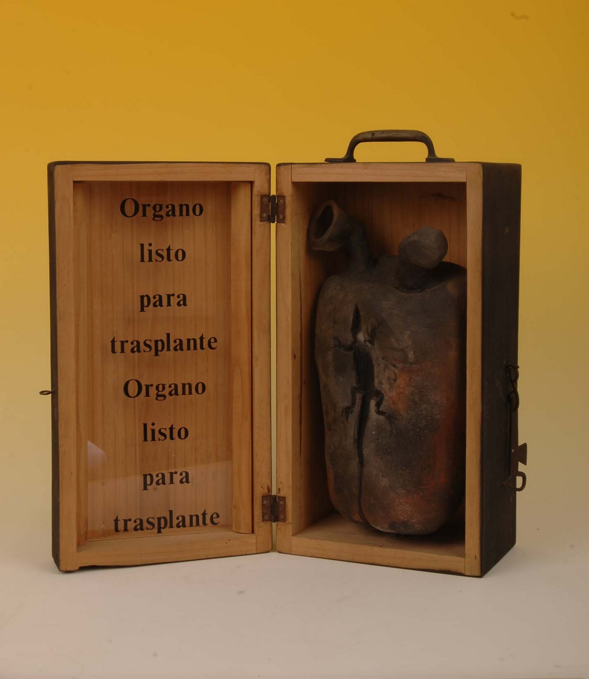 Órgano listo para trasplante 