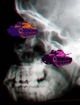 Radiografía invasiva
